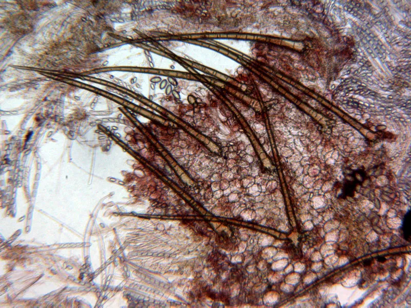 Cheilymenia fimicola 10 - Pelos x 100 1